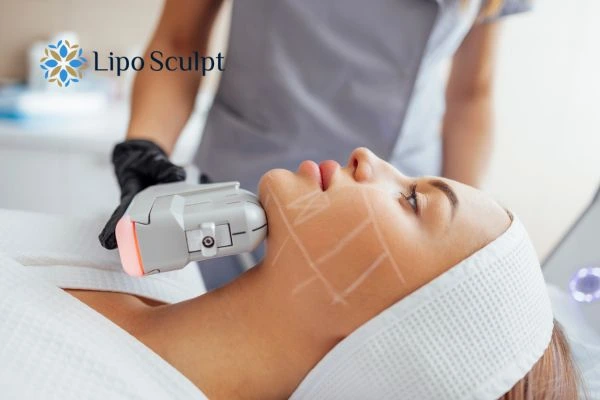 HIFU vs Botulinum Toxin: Understanding the Differences 1 HIFU vs Botox Spring Bank What is the best option for you?